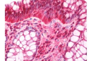 Human Colon: Formalin-Fixed, Paraffin-Embedded (FFPE). (PSMB2 抗体  (Biotin))