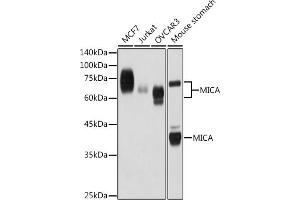 Western blot analysis of extracts of various cell lines, using MICA antibody (ABIN7268508) at 1:1000 dilution. (MICA 抗体)