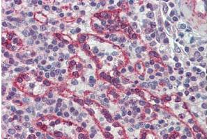 Human Spleen: Formalin-Fixed, Paraffin-Embedded (FFPE) (IRAK2 抗体  (AA 111-210))