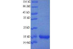 SDS-PAGE (SDS) image for Group XIIA Secretory Phospholipase A2 (PG12A) (AA 26-192) protein (His-SUMO Tag) (ABIN5711777)
