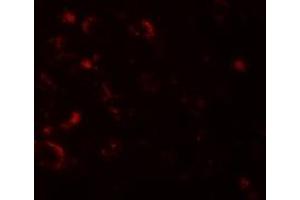 Immunofluorescence (IF) image for anti-Axin 1 (AXIN1) (C-Term) antibody (ABIN1030273)