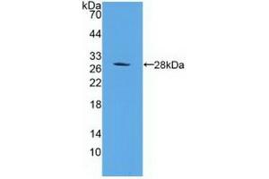 Detection of Recombinant PSMD10, Human using Polyclonal Antibody to Proteasome 26S Subunit, Non ATPase 10 (PSMD10) (PSMD10 抗体  (AA 1-226))