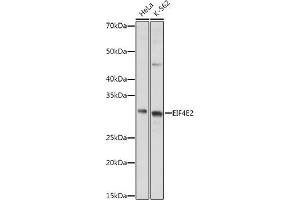 Western blot analysis of extracts of various cell lines, using EIF4E2 antibody (ABIN6130366, ABIN6140086, ABIN6140087 and ABIN6220578) at 1:1000 dilution. (EIF4E2 抗体  (AA 1-240))