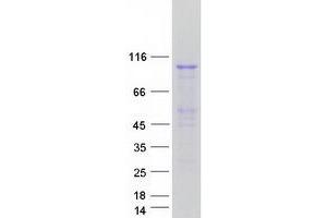 Western Blotting (WB) image for Mismatch Repair Protein 2 (MSH2) protein (Myc-DYKDDDDK Tag) (ABIN2726435)