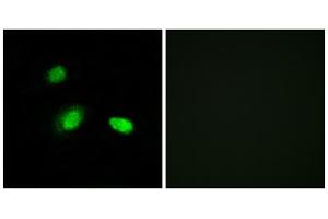 Immunofluorescence analysis of A549 cells, using HSPB2 antibody. (HSPB2 抗体  (C-Term))