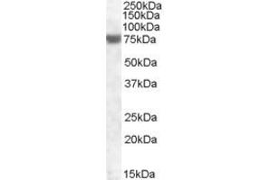 Western Blotting (WB) image for anti-Fem-1 Homolog A (FEM1A) (AA 656-669) antibody (ABIN490527) (FEM1A 抗体  (AA 656-669))