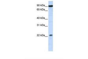 Image no. 1 for anti-Transmembrane and Tetratricopeptide Repeat Containing 4 (TMTC4) (AA 650-699) antibody (ABIN6738139) (TMTC4 抗体  (AA 650-699))