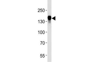 EGF Receptor antibody western blot analysis in HeLa lysate (EGFR 抗体  (AA 1163-1191))