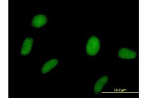 Immunofluorescence of purified MaxPab antibody to SPOP on HeLa cell. (SPOP-B 抗体  (AA 1-374))