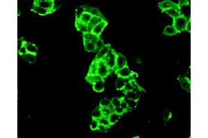 Figure:FITC staining on IHC-P Simple: Mcf7 cells (Hexokinase 2 抗体  (AA 619-917))