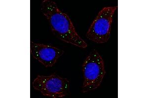 Fluorescent image of U251 cell stained with MERTK Antibody. (MERTK 抗体)