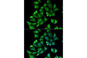 Immunofluorescence analysis of A549 cells using ENTPD2 antibody. (ENTPD2 抗体)