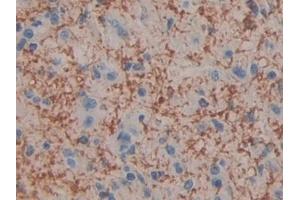Immunohistochemistry (IHC) image for anti-Cell Death-Inducing DFFA-Like Effector C (CIDEC) (AA 1-251) antibody (ABIN7440137)
