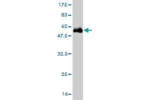 Western Blot detection against Immunogen (54. (UROS 抗体  (AA 1-265))