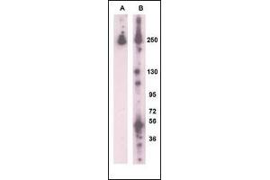 Western blot analysis of RK8 (LRRK2) (arrow) using rabbit polyclonal RK8 (LRRK2)Antibody  g. (LRRK2 抗体  (AA 931-962))