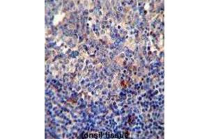 Immunohistochemistry (IHC) image for anti-B-Cell CLL/lymphoma 10 (BCL10) antibody (ABIN2995789) (BCL10 抗体)