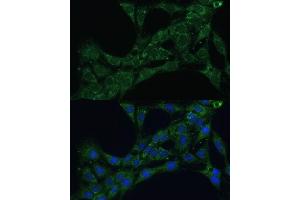 Immunofluorescence analysis of C6 cells using ETFB Polyclonal Antibody (ABIN7266916) at dilution of 1:100 (40x lens). (ETFB 抗体  (AA 80-230))
