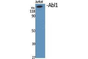 Western Blot (WB) analysis of specific cells using Abl1 Polyclonal Antibody. (ABL1 抗体  (Ser12))