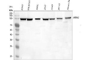 Western blot analysis of MSH2 using anti-MSH2 antibody (ABIN3043885). (MSH2 抗体  (AA 337-583))