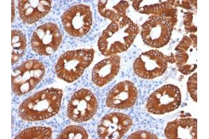 Formalin-fixed, paraffin-embedded human Normal Colon stained with Cytokeratin 20 (KRT20) Mouse Monoclonal Antibody (KRT20/1991).