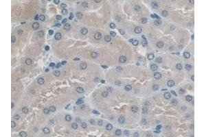 Immunohistochemistry (IHC) image for anti-Protein Interacting With Protein Kinase C, alpha 1 (PICK1) (AA 24-229) antibody (ABIN1860209)