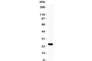 Western blot testing of Cyclin D3 antibody and recombinant human protein (0. (Cyclin D3 抗体  (AA 136-292))