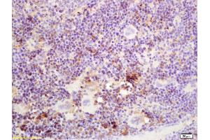 Formalin-fixed and paraffin embedded mouse spleen labeled with Rabbit Anti SSA/52KDa Ro3 Polyclonal Antibody, Unconjugated (ABIN671196) at 1:200 followed by conjugation to the secondary antibody and DAB staining (TRIM21 抗体  (AA 301-400))
