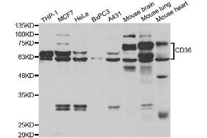 Western blot analysis of extracts of various cell lines, using CD36 antibody. (CD36 抗体)