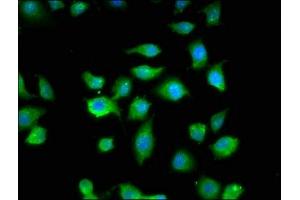 Immunofluorescence staining of A549 cells with ABIN7160609 at 1:200, counter-stained with DAPI. (MYBPC1 抗体  (AA 618-779))