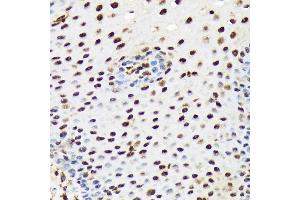 Immunohistochemistry of paraffin-embedded human esophageal using PRP19 Rabbit mAb (ABIN7269505) at dilution of 1:100 (40x lens). (PRP19 抗体)