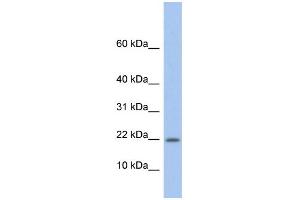 WB Suggested Anti-NDP Antibody Titration: 0. (Norrie Disease (Pseudoglioma) 抗体  (Middle Region))