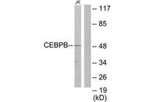 Western blot analysis of extracts from Jurkat cells, using CEBPB Antibody. (CEBPB 抗体  (AA 231-280))