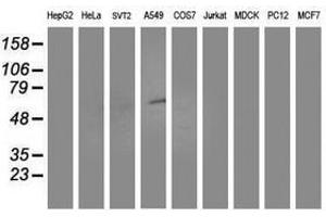 Image no. 2 for anti-Aldehyde Dehydrogenase 3 Family, Member A2 (ALDH3A2) antibody (ABIN1496596) (ALDH3A2 抗体)
