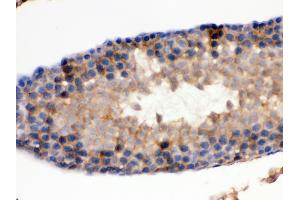 Immunohistochemistry (Paraffin-embedded Sections) (IHC (p)) image for anti-Isocitrate Dehydrogenase 1 (NADP+), Soluble (IDH1) (AA 381-413), (C-Term) antibody (ABIN3043855) (IDH1 抗体  (C-Term))