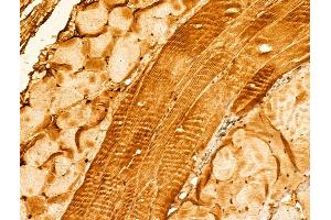 anti-Synaptopodin 2 (SYNPO2) (Internal Region) antibody