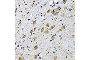 Immunohistochemistry of paraffin-embedded mouse brain using SLC23A2 antibody (ABIN5974077) at dilution of 1/100 (40x lens). (SLC23A2 抗体)