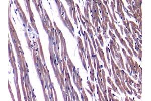 Detection of NPPA in Rat Heart Tissue using Polyclonal Antibody to Natriuretic Peptide Precursor A (NPPA) (NPPA 抗体  (AA 25-152))