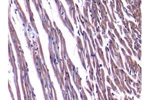 Detection of NPPA in Rat Heart Tissue using Polyclonal Antibody to Natriuretic Peptide Precursor A (NPPA)