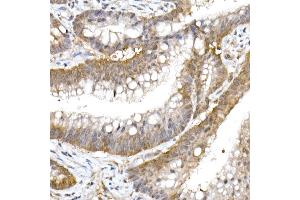 Immunohistochemistry of paraffin-embedded human colon carcinoma using UFM1 Rabbit mAb (ABIN7271183) at dilution of 1:50 (40x lens). (UFM1 抗体)