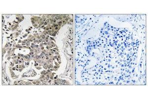 Immunohistochemistry (IHC) image for anti-Protein Phosphatase 2, Regulatory Subunit A, beta (PPP2R1B) (C-Term) antibody (ABIN1852118) (PPP2R1B 抗体  (C-Term))