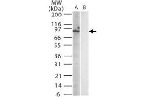Western blot analysis of mouse Trl12 in (A) transfected and (B) untransfected cell lysate using Trl12 monoclonal antibody, clone 15F1215  at 1:1000. (TLR12 抗体  (AA 791-806))