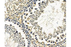 ABIN7096615 and ABIN7100679 at 1/100 staining rat testis tissue by IHC-P. (ARMC9 抗体)