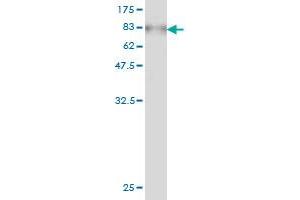Western Blot detection against Immunogen (78. (AKT1 抗体  (AA 1-480))