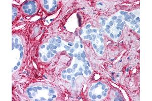 Anti-Collagen VI antibody IHC of human breast. (COL6 抗体)