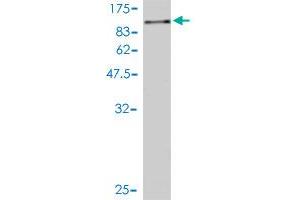 Western Blot detection against Immunogen (98. (alpha Adducin 抗体  (AA 1-662))