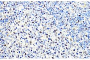 Immunohistochemistry of paraffin-embedded Rat spleen using CTCF Polyclonal Antibody at dilution of 1:100 (40x lens). (CTCF 抗体)