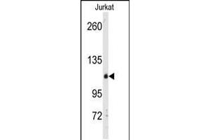 Western blot analysis of anti-anti-DGK delta Pab in Jurkat cell line lysates (35ug/lane) (DGKD 抗体  (C-Term))