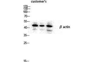 Western Blot (WB) analysis of lysis using Actin beta antibody. (beta Actin 抗体  (N-Term))