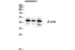 Western Blot (WB) analysis of lysis using Actin beta antibody.