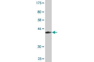 Western Blot detection against Immunogen (37. (MAGEB6 抗体  (AA 135-244))